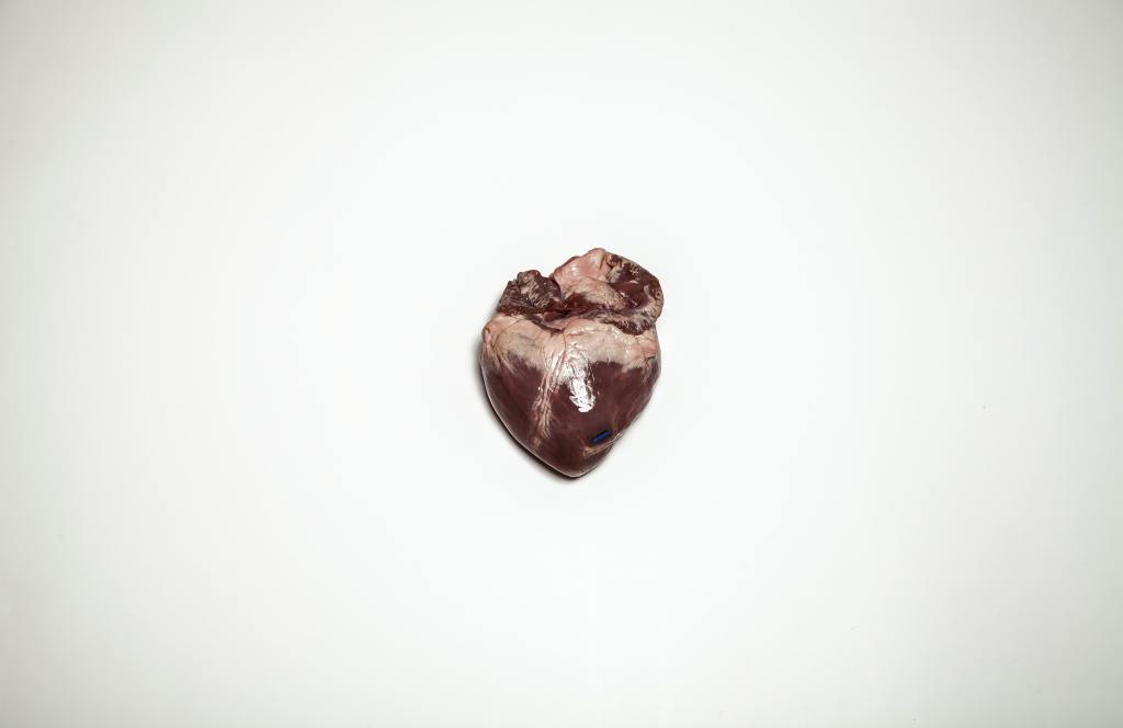 Qué es el Riesgo&nbsp;Cardiovascular